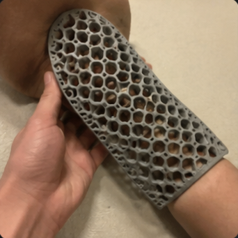 Finger Splint