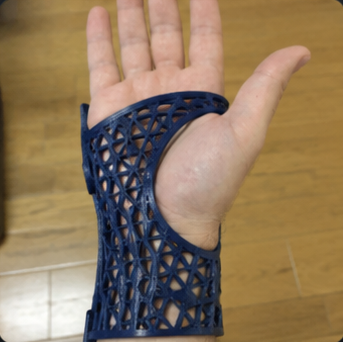 Wrist Splint